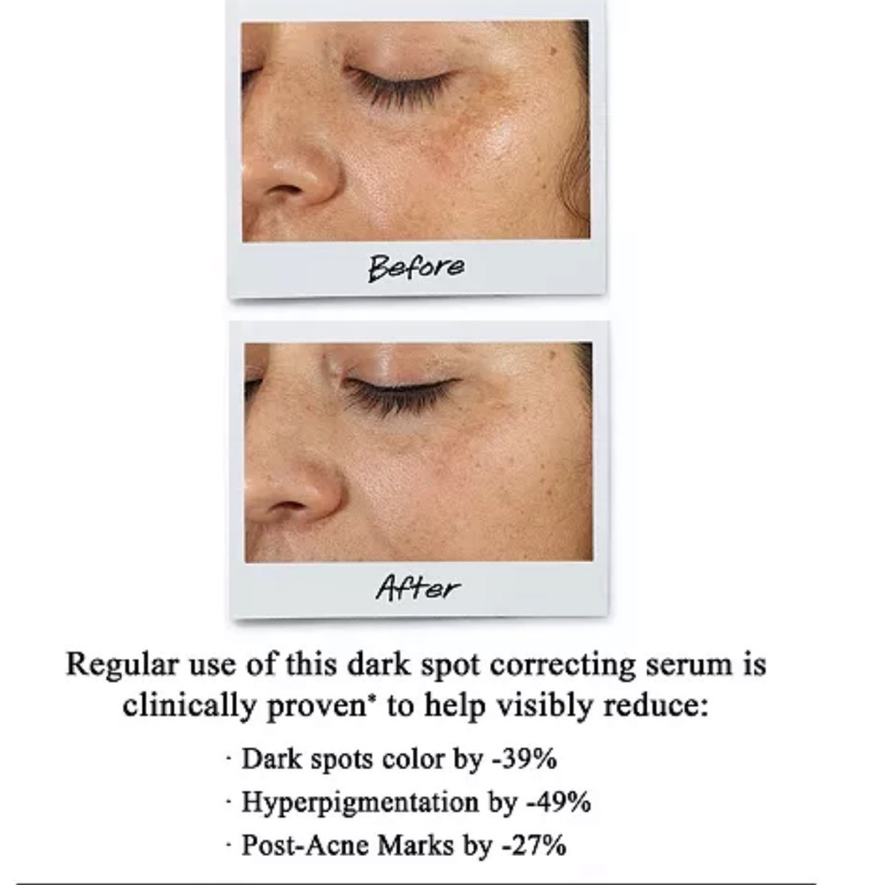 Kiehl's Clearly Corrective‎ Dark Spot Solution sold - Picture 6 of 8